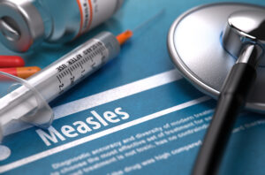 measles